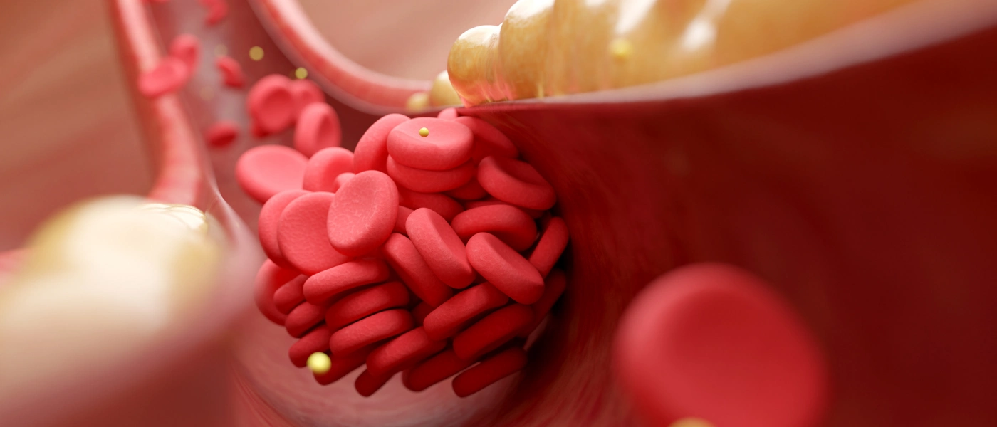 cholesterin was die zahl wirklich sagt und was nicht